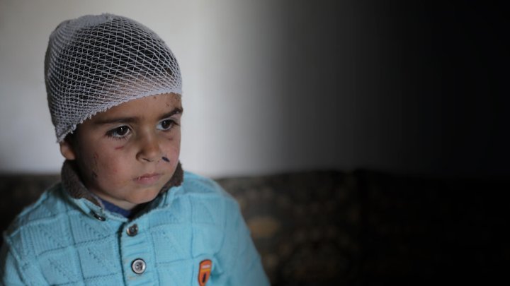 niño herido en primer plano mirando con tristeza 