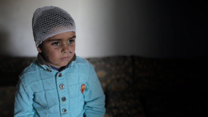 niño herido con la cabeza vendada, triste mirando al horizonte