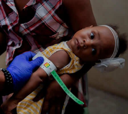 Bebé con desnutrición severa en Colombia recibiendo atención — dona aquí para combatir la desnutrición infantil con UNICEF